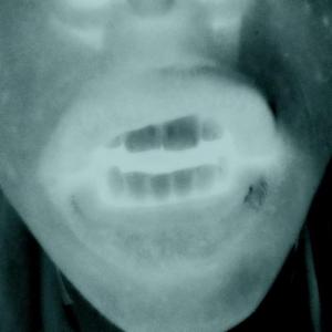 magn5832