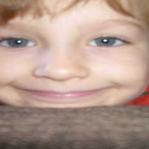 prodkoppe