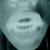 magn5832